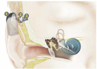 Full Hearing Assessment